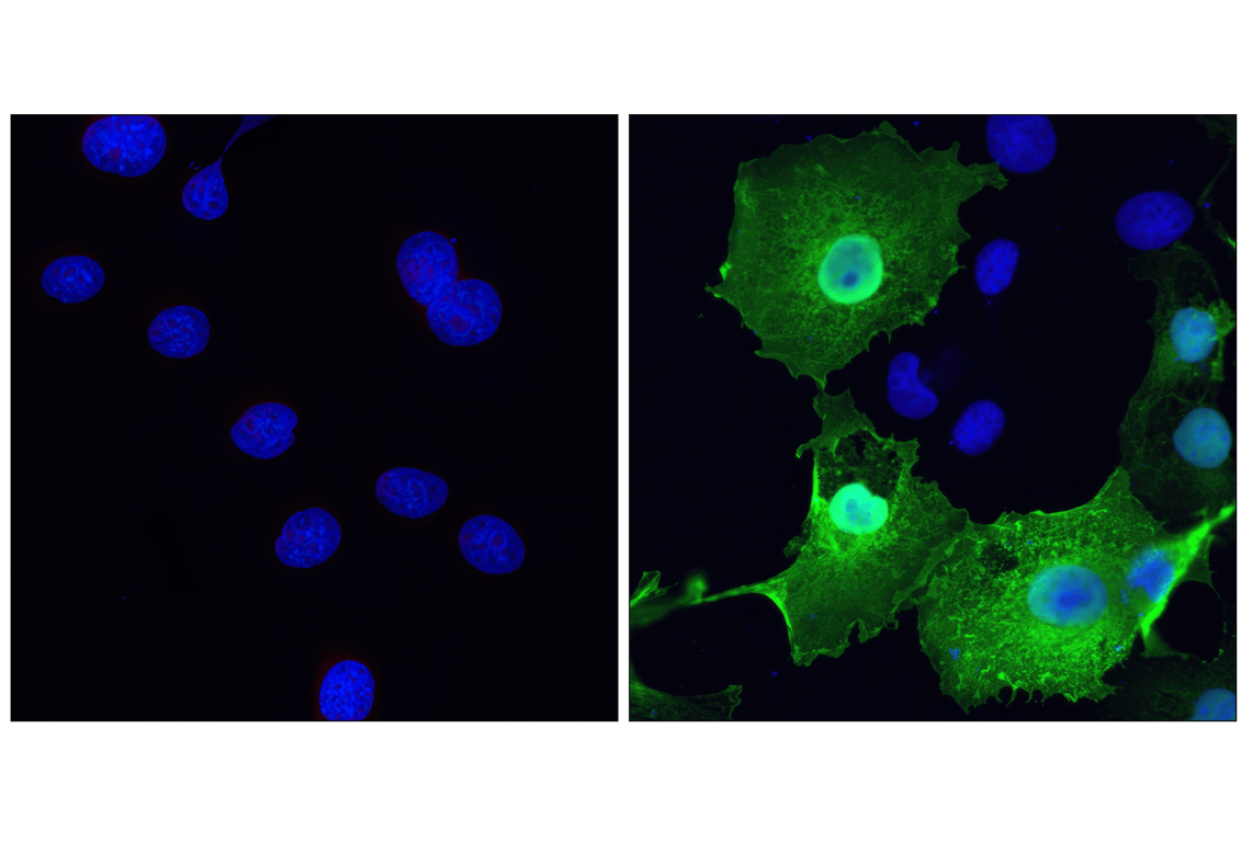 Immunofluorescence Image 2: HA-Tag (6E2) Mouse Monoclonal Antibody