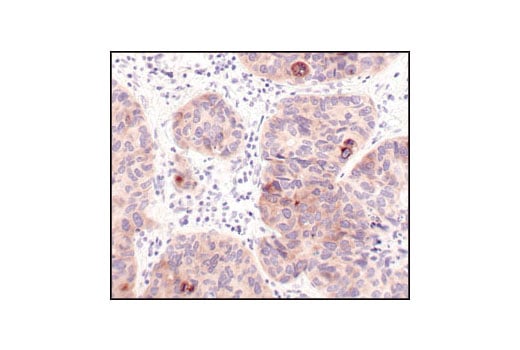 undefined Image 28: Alzheimer's Disease Antibody Sampler Kit