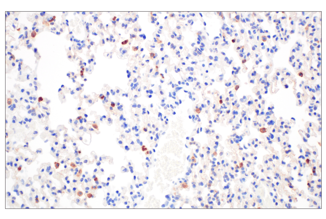Immunohistochemistry Image 5: DAP12 (F1Q2P) Rabbit Monoclonal Antibody