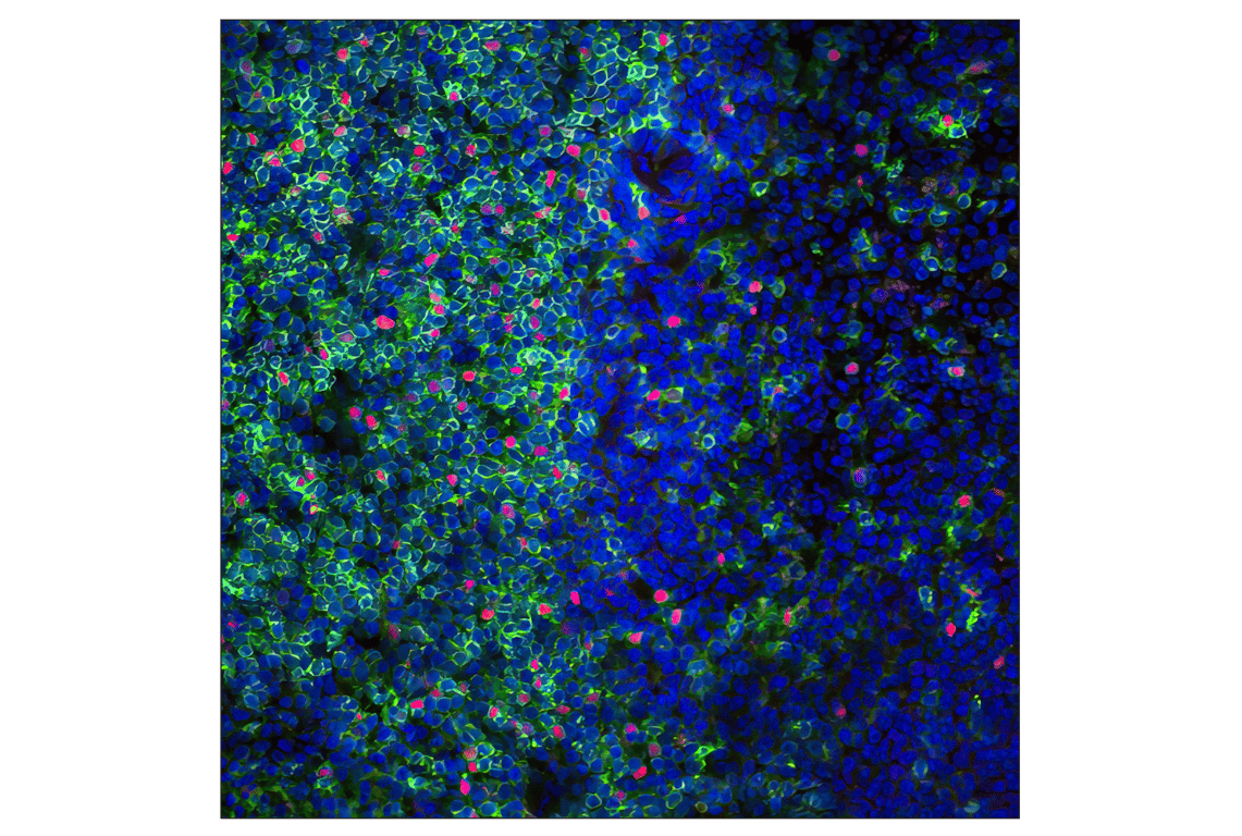 Immunofluorescence Image 1: FoxP3 (D6O8R) Rabbit Monoclonal Antibody