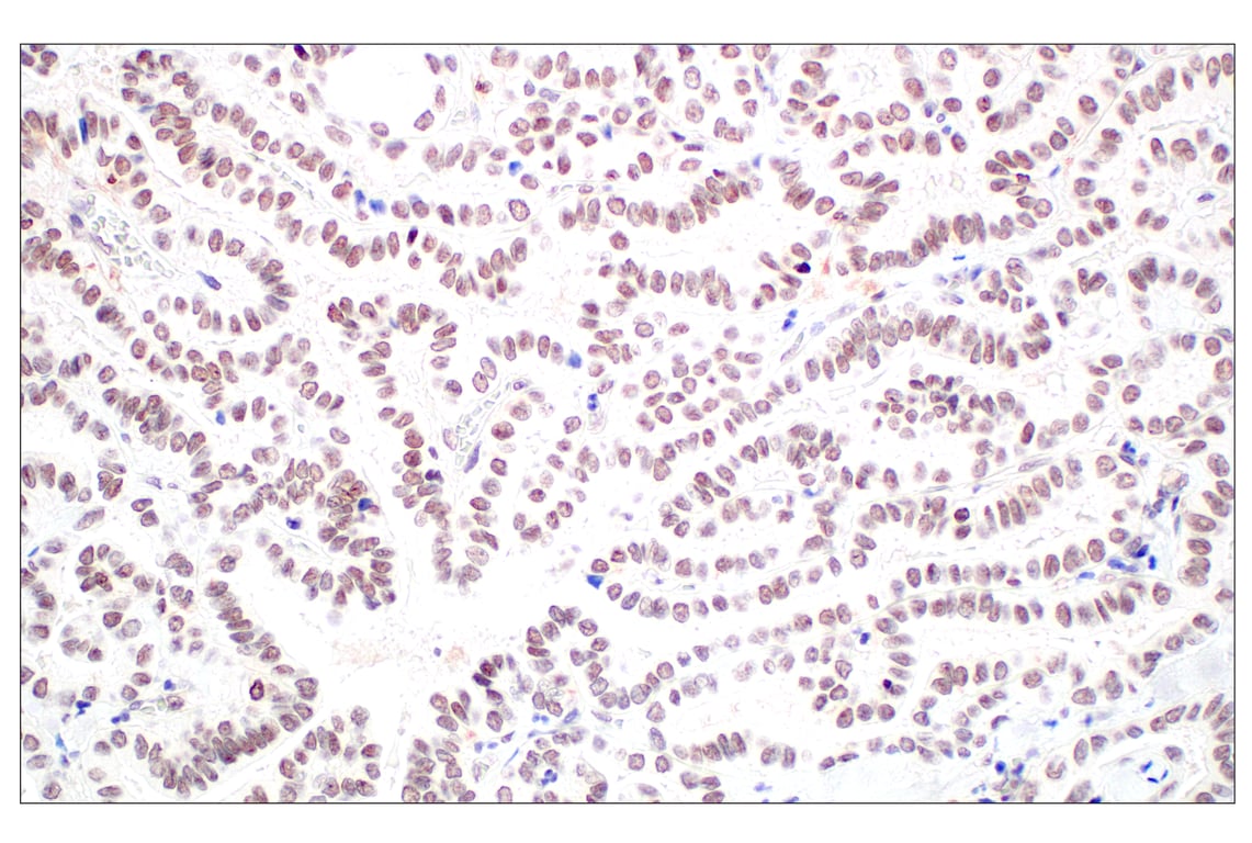 Immunohistochemistry Image 4: Menin (E5P1R) Rabbit Monoclonal Antibody