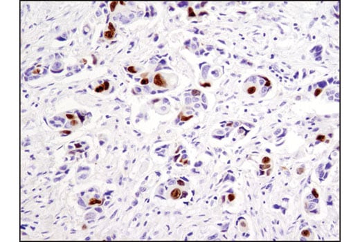 Immunohistochemistry Image 1: Topoisomerase II alpha (D10G9) Rabbit Monoclonal Antibody