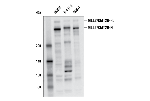 Western Blotting Image 2: MLL2/KMT2B (E3M1V) Rabbit Monoclonal Antibody (Amino-terminal Antigen)