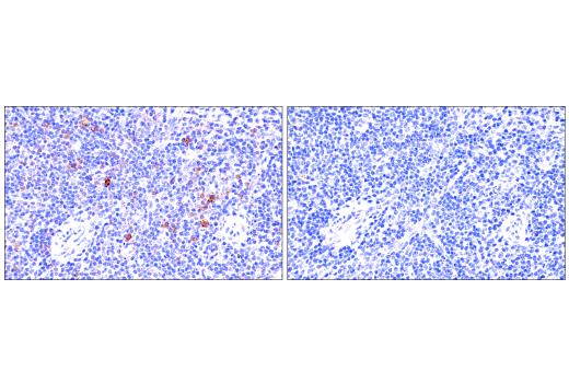 Immunohistochemistry Image 7: ICOS (E5F7E) Rabbit Monoclonal Antibody