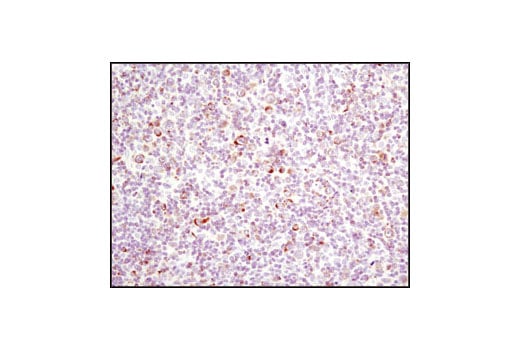 undefined Image 30: Pro-Apoptosis Bcl-2 Family Antibody Sampler Kit
