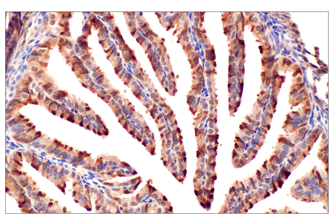 Immunohistochemistry Image 8: MTAP (E5R1I) Rabbit Monoclonal Antibody
