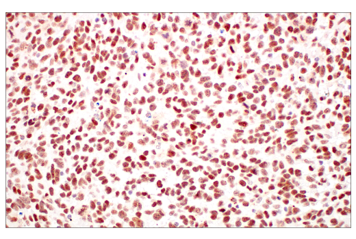 Immunohistochemistry Image 12: TIF1 alpha/TRIM24 (E9T3N) Rabbit Monoclonal Antibody