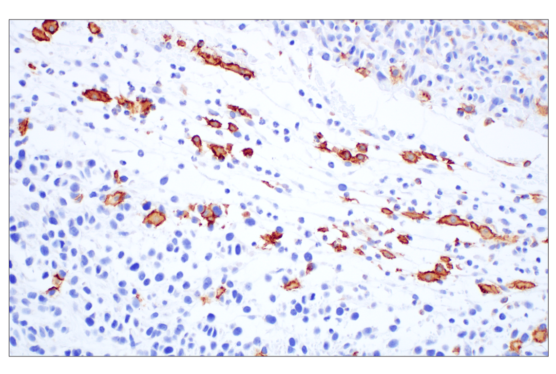 Immunohistochemistry Image 1: Siglec-1/CD169 (E1D7G) Rabbit Monoclonal Antibody (BSA and Azide Free)
