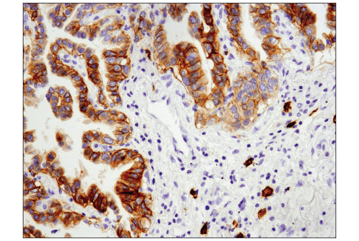 Immunohistochemistry Image 1: c-Kit (D3W6Y) Rabbit Monoclonal Antibody (BSA and Azide Free)