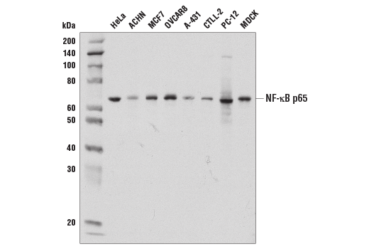 Western Blotting Image 1: NF-κB p65 (D14E12) XP<sup>®</sup> Rabbit mAb (BSA and Azide Free)