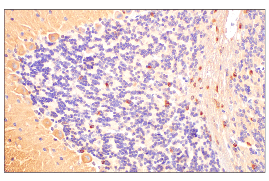 Immunohistochemistry Image 5: Phospho-Tau (Ser202) (F2A2F) Rabbit Monoclonal Antibody