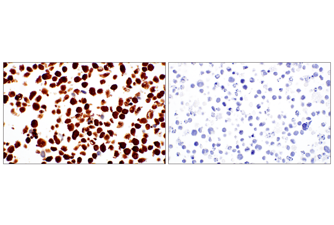 Immunohistochemistry Image 11: p16 INK4A (F9T1L) Rabbit Monoclonal Antibody