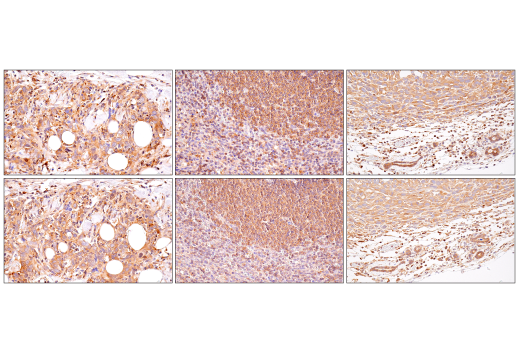Immunohistochemistry Image 5: NF-kappaB1 p105/p50 (D7H5M) Rabbit Monoclonal Antibody (BSA and Azide Free)