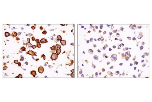 Immunohistochemistry Image 2: IQGAP1 (D8K4X) Rabbit Monoclonal Antibody