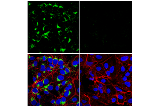 Immunofluorescence Image 1: Furin (E1W4O) Rabbit Monoclonal Antibody