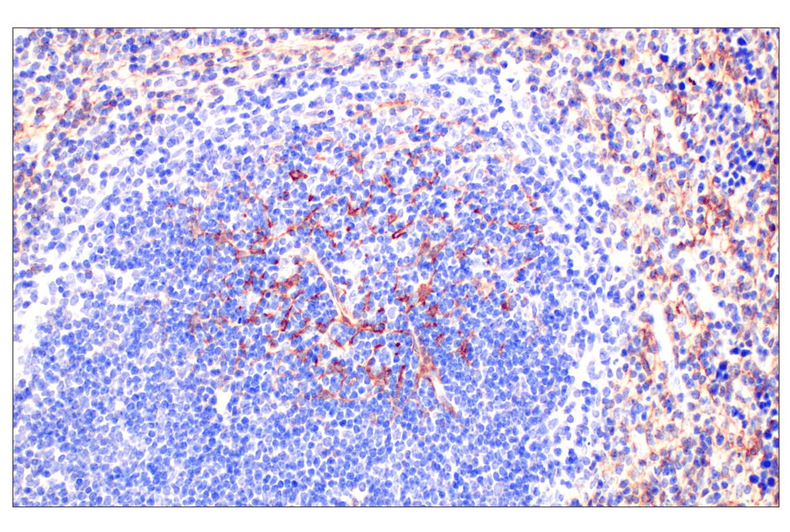 Immunohistochemistry Image 5: CD10/Neprilysin (F4P6H) Rabbit Monoclonal Antibody