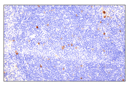 Immunohistochemistry Image 1: Phospho-SLP-76 (Ser376) (E3G9U) Rabbit Monoclonal Antibody (BSA and Azide Free)