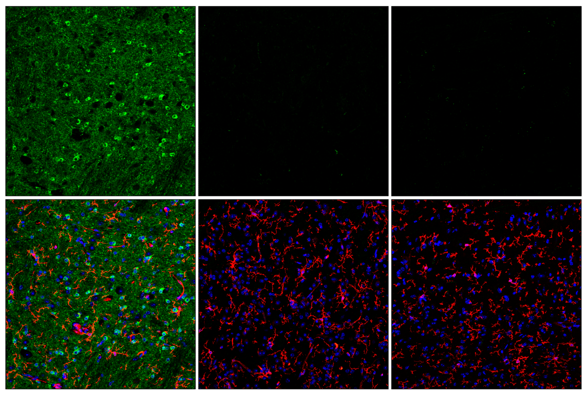 Immunofluorescence Image 1: Phospho-Tau (Ser404) (D2Z4G) Rabbit Monoclonal Antibody (IHC/IF Formulated)