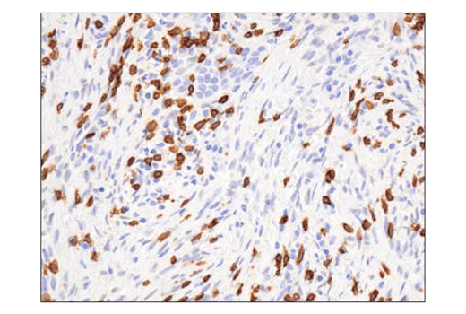 Immunohistochemistry Image 1: CD3 epsilon (D7A6E<sup>™</sup>) Rabbit Monoclonal Antibody