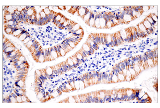 Immunohistochemistry Image 4: CPS1/Hep Par-1 (E9I9U) Rabbit Monoclonal Antibody (BSA and Azide Free)