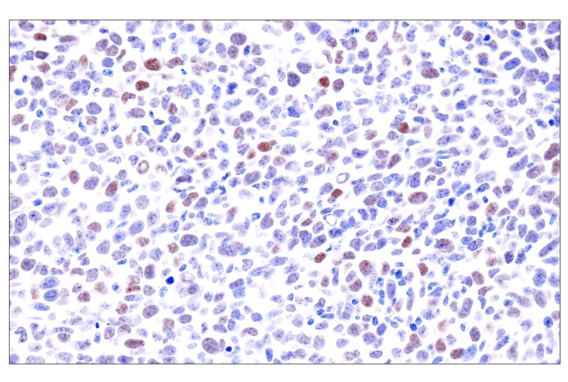 Immunohistochemistry Image 16: GATA-6 (D61E4) Rabbit Monoclonal Antibody