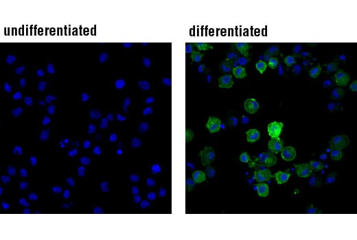Immunofluorescence Image 1: DC-SIGN (D7F5C) Rabbit Monoclonal Antibody (BSA and Azide Free)