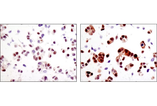 undefined Image 24: Hippo Signaling Antibody Sampler Kit