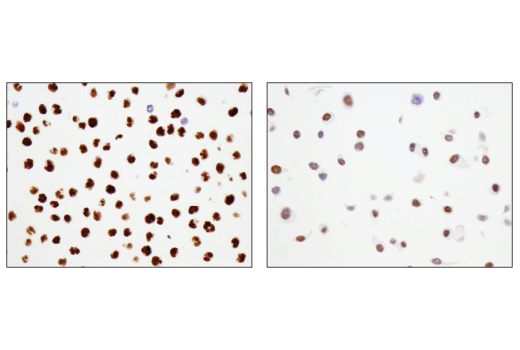 Immunohistochemistry Image 1: ATF-2 (D4L2X) Rabbit Monoclonal Antibody (BSA and Azide Free)