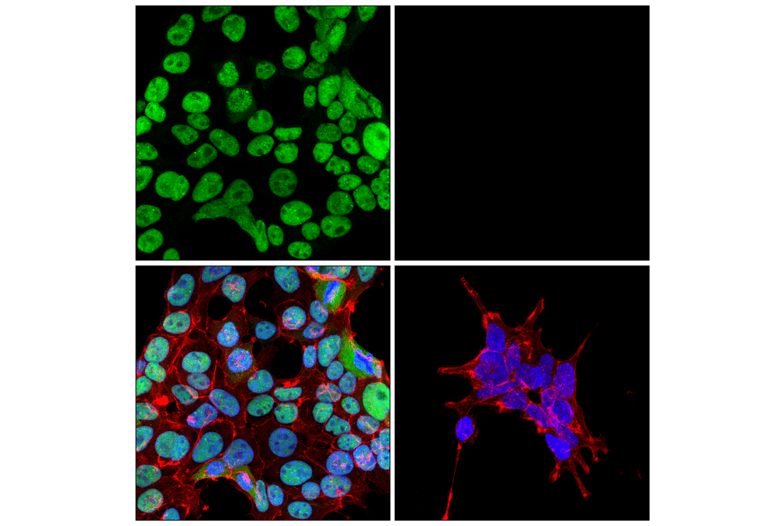 TDP43 (D9R3L) Rabbit Monoclonal Antibody | Cell Signaling Technology