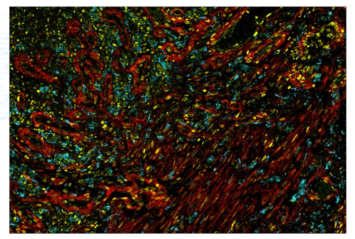 Immunohistochemistry Image 1: alpha-Smooth Muscle Actin (D4K9N) & CO-0024-488 SignalStar<sup>™</sup> Oligo-Antibody Pair