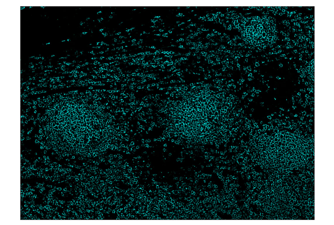 Immunohistochemistry Image 5: CD20 (E7B7T) & CO-0011-594 SignalStar<sup>™</sup> Oligo-Antibody Pair