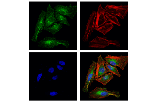 undefined Image 32: Vesicle Trafficking Antibody Sampler Kit