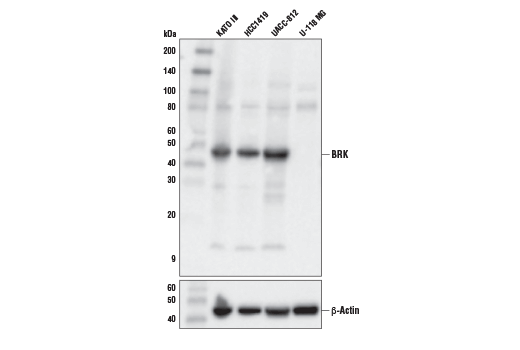 Western Blotting Image 1: PTK6/BRK (D4O2D) Rabbit mAb