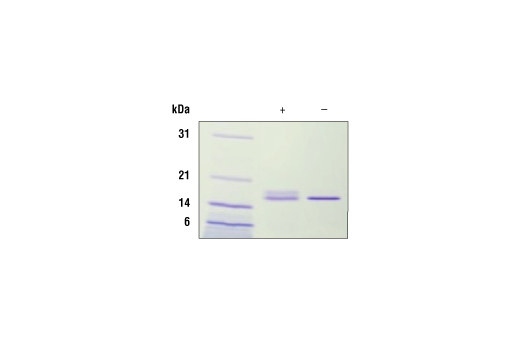 undefined Image 2: Human IL-7 Recombinant Protein