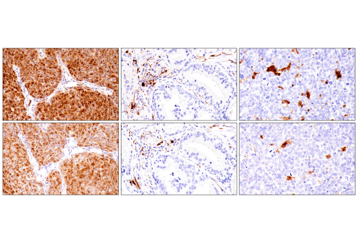 Immunohistochemistry Image 5: S100B (E7C3A) Rabbit Monoclonal Antibody