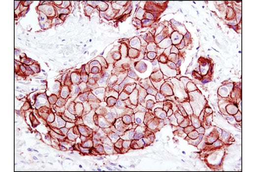 Immunohistochemistry Image 1: HER2/ErbB2 (D8F12) Rabbit Monoclonal Antibody