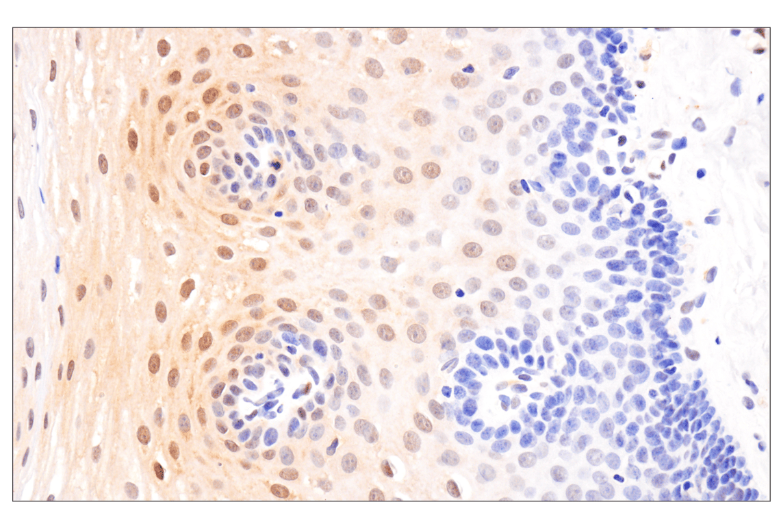 Immunohistochemistry Image 7: Phospho-Stat3 (Ser727) (D4X3C) Rabbit Monoclonal Antibody (BSA and Azide Free)