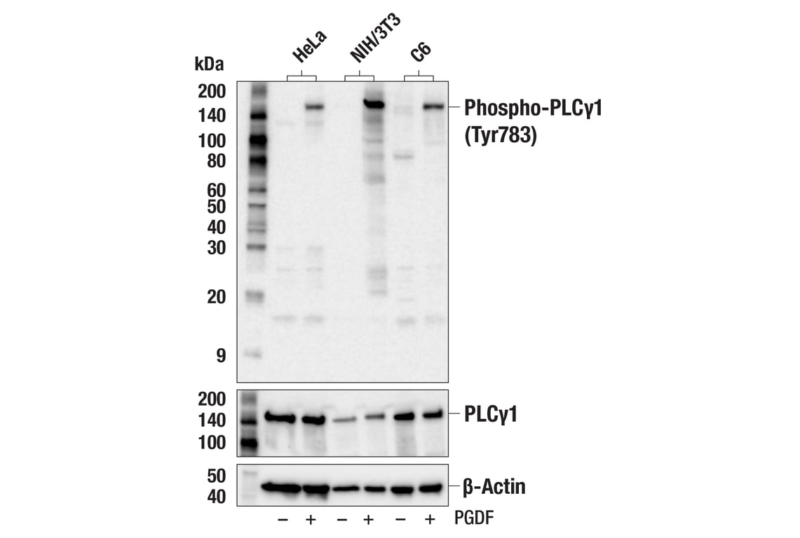 Western Blotting Image 1: Phospho-PLC gamma1 (Tyr783) Antibody