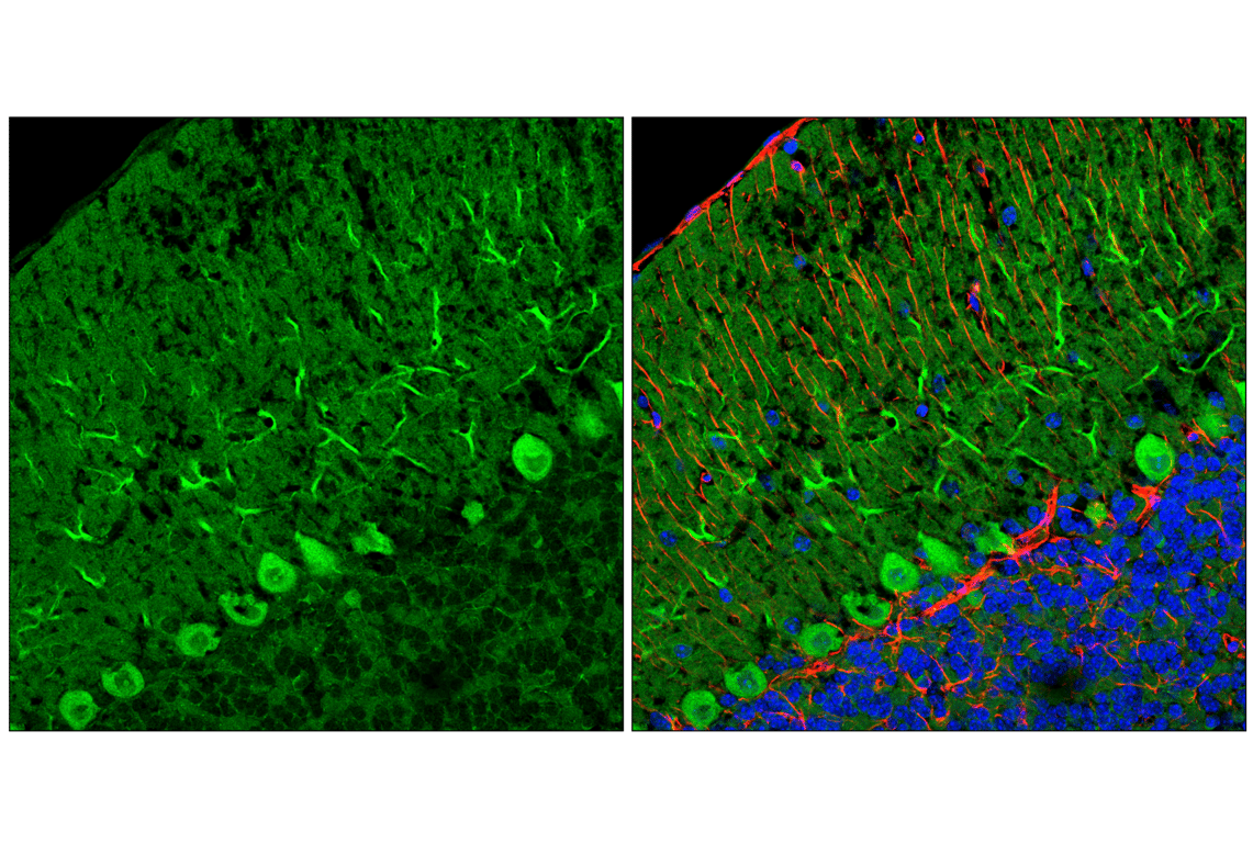 Immunofluorescence Image 1: LC3B (E5Q2K) Mouse Monoclonal Antibody (BSA and Azide Free)