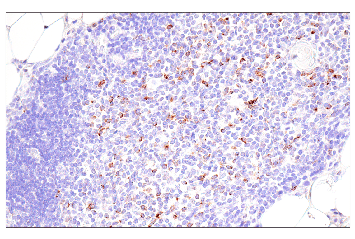Immunohistochemistry Image 6: CTLA-4 (E2V1Z) Rabbit Monoclonal Antibody