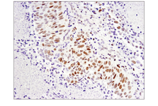 Immunohistochemistry Image 3: SLFN11 (D8W1B) Rabbit Monoclonal Antibody
