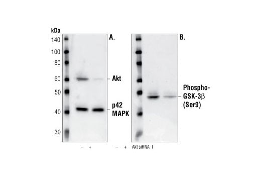 Western Blotting Image 1: Akt Antibody