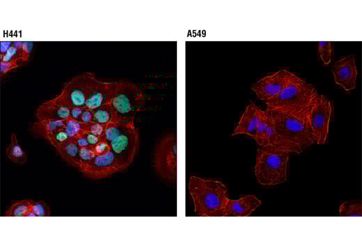 Immunofluorescence Image 1: Thyroid Transcription Factor 1 (TTF-1) (D2E8) Rabbit Monoclonal Antibody