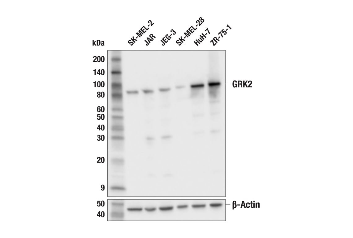 Western Blotting Image 1: GRK2 (E8A7E) Rabbit mAb