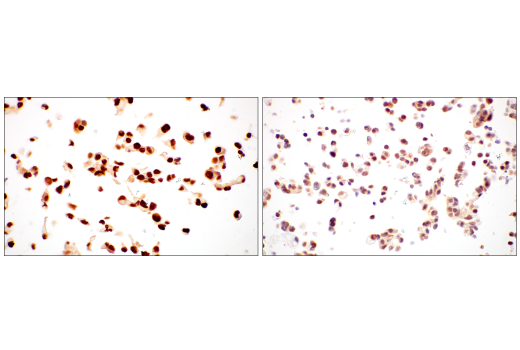 Immunohistochemistry Image 11: Rad50 (E4J5R) Rabbit Monoclonal Antibody