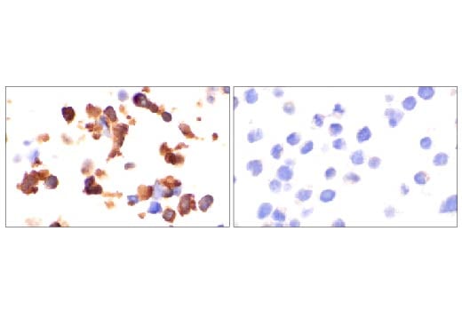 Immunohistochemistry Image 3: YAP (D8H1X) Rabbit Monoclonal Antibody (BSA and Azide Free)
