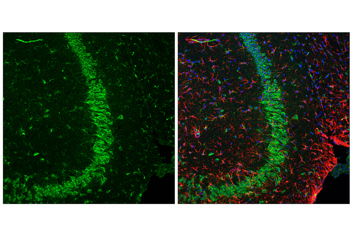 Immunofluorescence Image 2: HEXB (E9X5S) Rabbit Monoclonal Antibody (BSA and Azide Free)