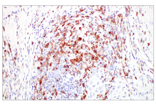 Immunohistochemistry Image 8: CD7 (E4G1Q) Rabbit Monoclonal Antibody (BSA and Azide Free)
