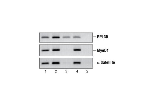 Chromatin Immunoprecipitation Image 1: Normal Rabbit IgG