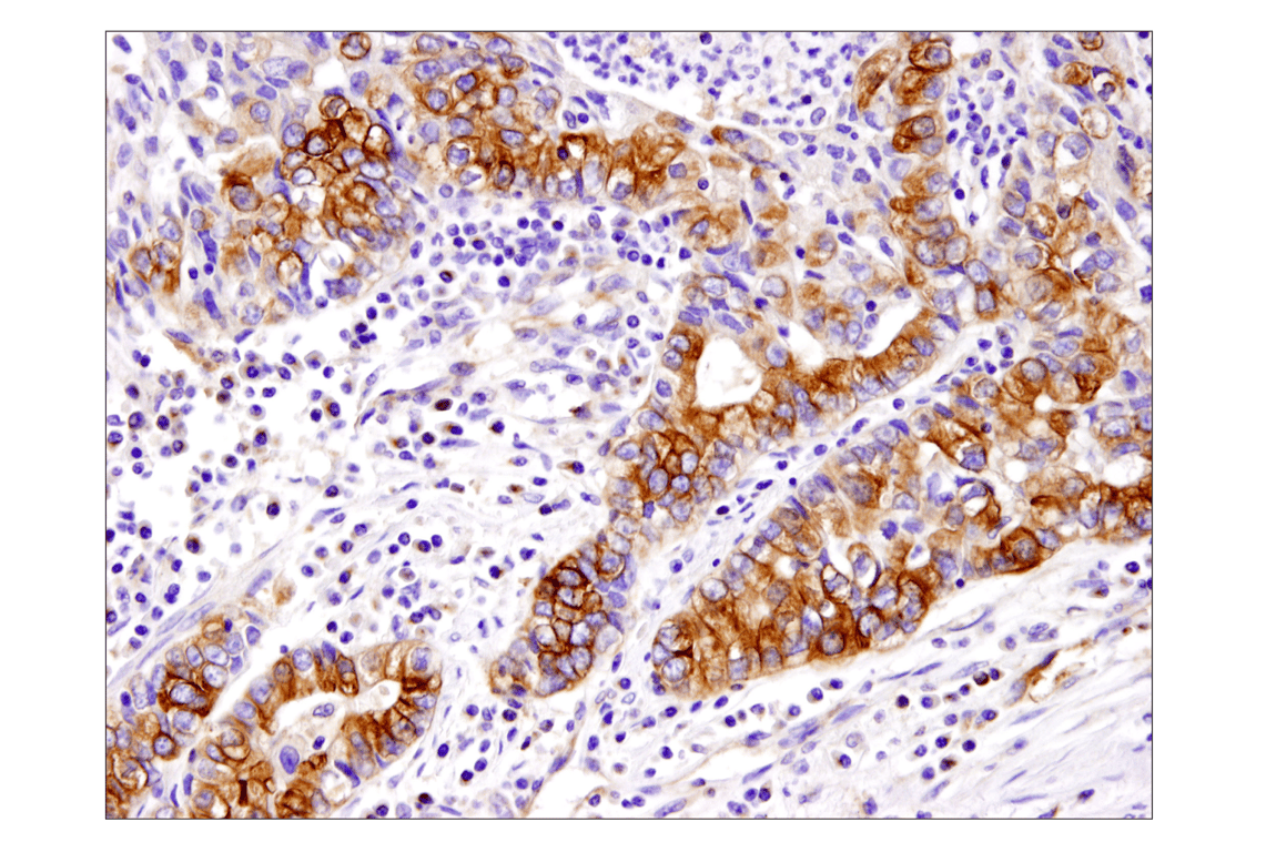 Immunohistochemistry Image 3: beta-Tubulin (D3U1W) Mouse Monoclonal Antibody (BSA and Azide Free)